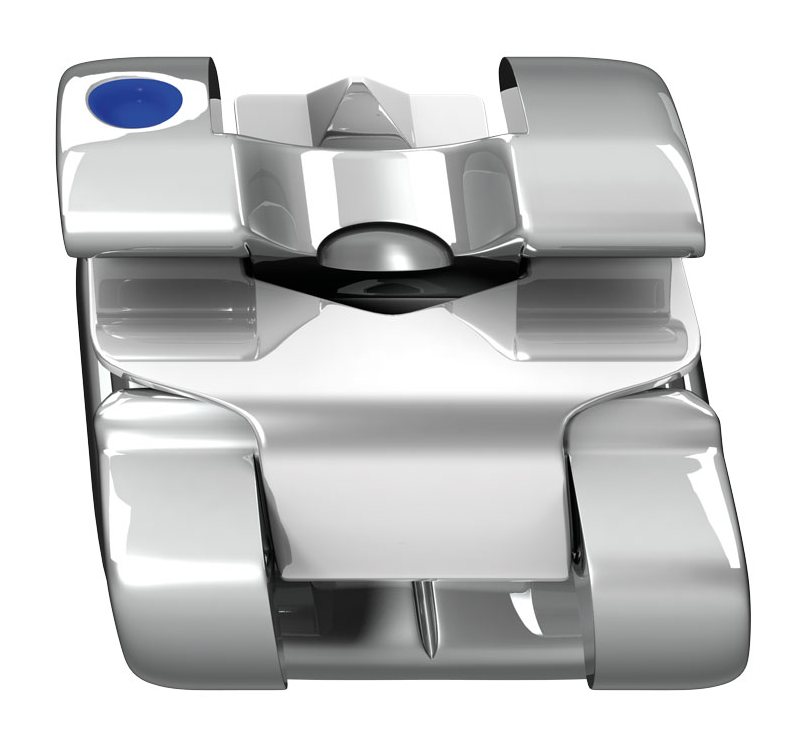 Experience Metal Metal Bracket Systems TOC Dental