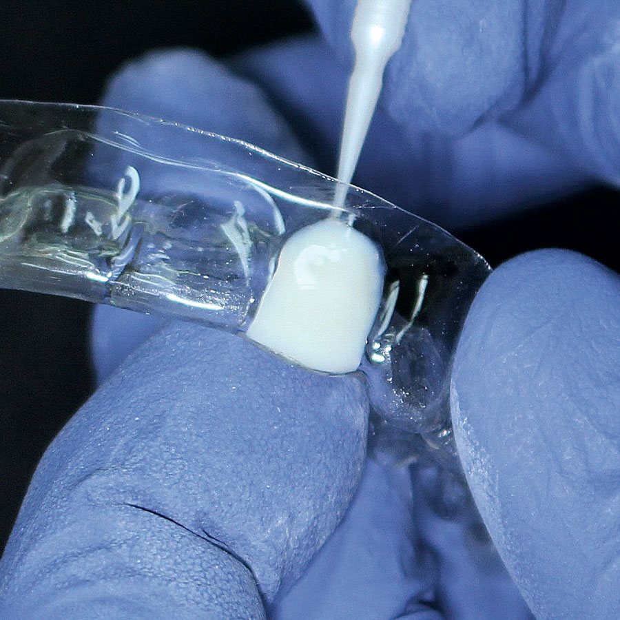 Reliance PerfectASmile Pontic Paint Bonding and Attachments TOC