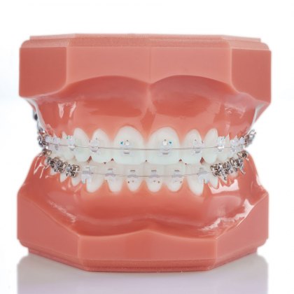 Experience C Bracket Kits Experience C Bracket Kits
