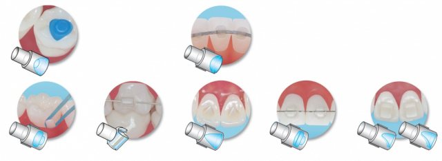 Mini-Mold - Miscellaneous - TOC Dental