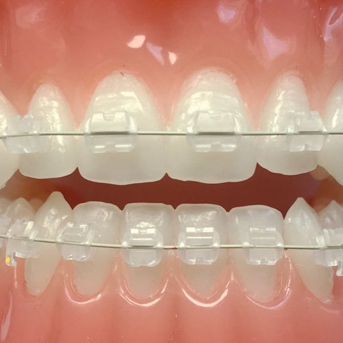 thumbnail image 2 of Easyinsmile Dental Orthodontic NITI Arch Wires – 10 Bags – Sizes 12/14/16 2 of 4