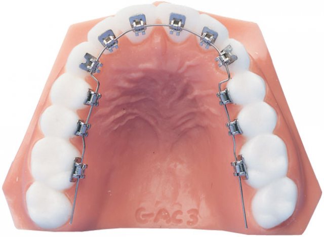 In-Ovation L Consultation Model