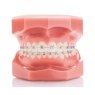 Legend Mini Rhodium Aesthetic Brackets