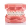 Legend Mini Rhodium Aesthetic Bracket Individuals