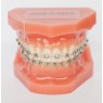 Verve Verve Bracket Kits