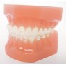 Verve Verve Ceramic Bracket Kit
