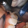 Swingle Ortho Professional Kit